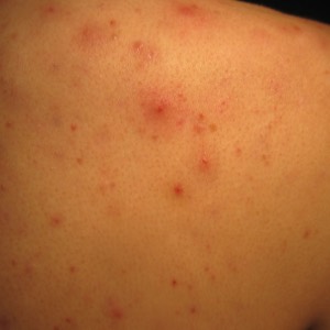 telemedicine image 1